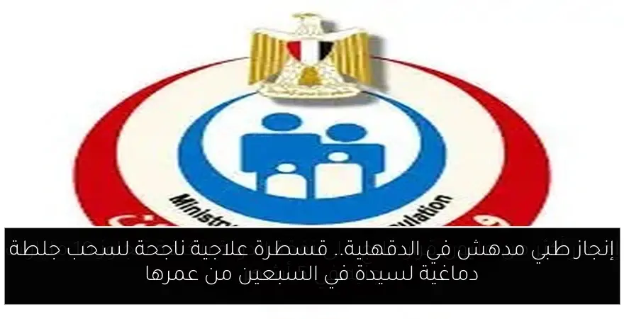 إنجاز طبي مدهش في الدقهلية.. قسطرة علاجية ناجحة لسحب جلطة دماغية لسيدة في السبعين من عمرها