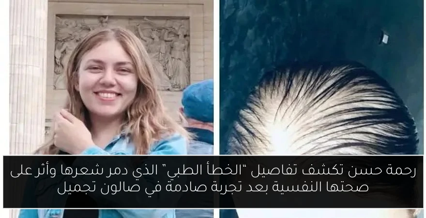 رحمة حسن تكشف تفاصيل “الخطأ الطبي” الذي دمر شعرها وأثر على صحتها النفسية بعد تجربة صادمة في صالون تجميل