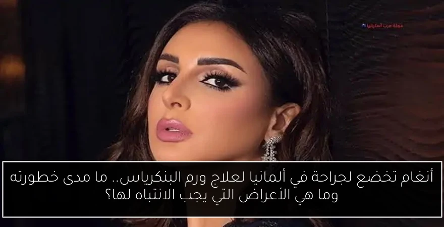 أنغام تخضع لجراحة في ألمانيا لعلاج ورم البنكرياس.. ما مدى خطورته وما هي الأعراض التي يجب الانتباه لها؟